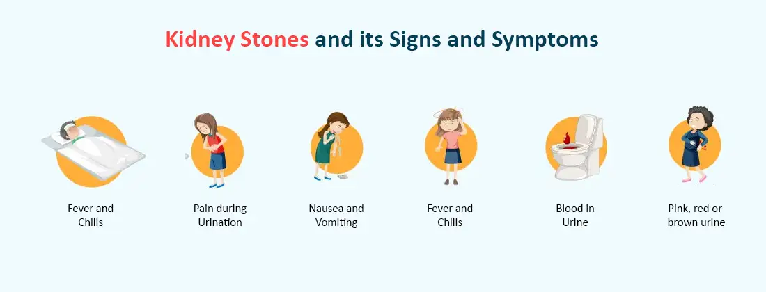 Kidney Stones and Its Signs and Symptoms